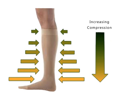 Compression Therapy Los Angeles | Graduated Compression Stockings